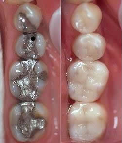 Zahnarzt Penteke, Zahnchirurgie, Zahnpraxis, Wurzelbehandlung, Zahnbehandlung